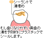 �V�[�����g