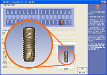 インプラントシュミレーションソフト