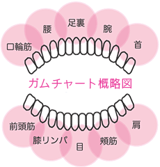 ガムチャート概略図