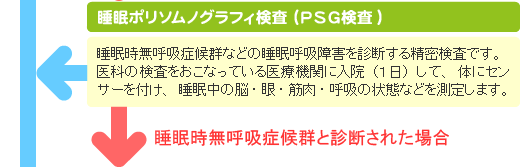 いびき・睡眠時無呼吸症候群の検査 睡眠ポリソムノグラフィ検査（PSG検査）