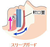 スリープガードの効果