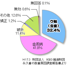 抜歯の主原因