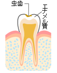 シーワン