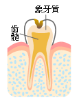 シーツー