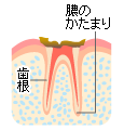 シーフォー