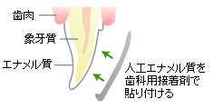 ラミネート