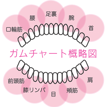 ガムチャート概略図