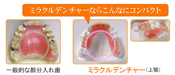 ミラクルデンチャーならこんなにコンパクト